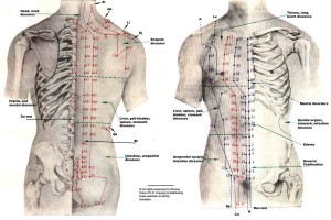 acupuncture treatment in Palmers green massage